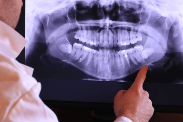 Best Pediatric Emergency Dentist in Tusculum, TN